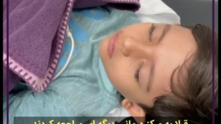 کشیدن دندان شیری با آرامبخشی