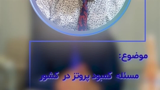 مسئله کمبود پروتز در کشور