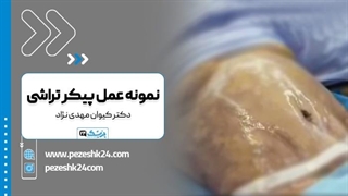 دکتر کیوان مهدی نژاد بهترین جراح پیکرتراشی تهران لیفت ابرو