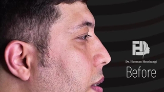 جراحی همزمان دو فک و چانه