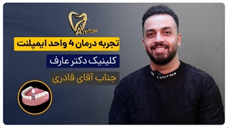 تجربه درمان ایمپلنت اقای قادری