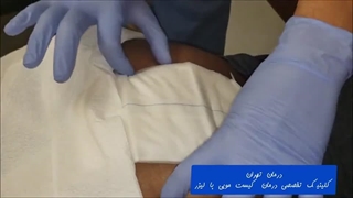 فیلم تعویض پانسمان کیست مویی یا سینوس پیلونیدال