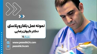 دکتر کیوان رضایی جراح و متخصص پلاستیک چشم در تهران اتوپلاستی