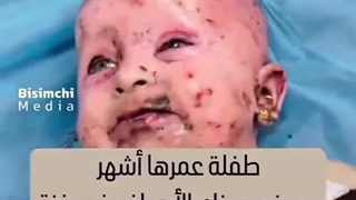 Videat mundus crimen infanticidii ab regimine Israelis