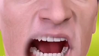 متخصص ایمپلنت مشهد