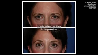 لیفت پیشانی کلینیک پوست