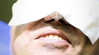 کاشت مو در کلینیک باران توس مشهد