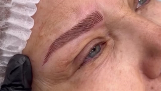 لیفت بروز ابرو