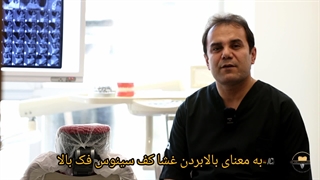 سینوس لیفت چیست