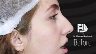 جراحی همزمان فک و چانه