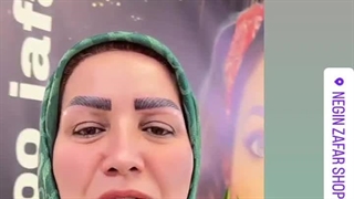 مرکز تخصصی ابرو چشم لب