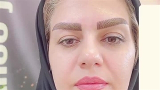 مرکز تخصصی ابرو چشم لب
