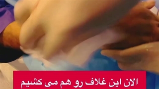 آنژیو پلاستی چقدر جراحت دارد؟