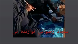 سجاد رضوانی برداشتن خال