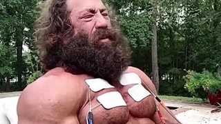 ویدئوی نگران کننده از اینفلوئنسر ملقب به «پادشاه کبد»