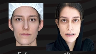 بهترین متخصص جراحی فک در تهران