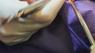 ایمپلنت کار حرفه ای-4