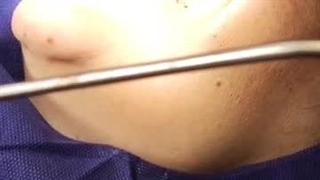 ایمپلنت کار ماهر-7