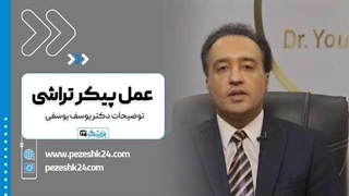دکتر یوسف یوسفی بهترین جراح پیکرتراشی در مشهد