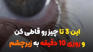 درمان تیرگی زیرچشم با عسل و قهوه