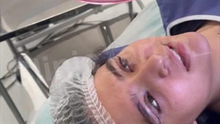 رفع افتادگی پلک در کلینیک آرتین