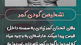 تشخیص گودی کمر