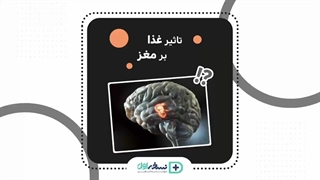 غذای مغز - داروخانه آنلاین نسخه اول - داروخانه اینترنتی نسخه اول