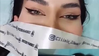 لیفت ابرو در کلینیک ارتین