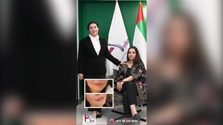 Achieve a Sculpted Jawline with Buccal Fat Removal and Gel Injection