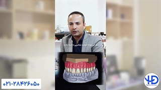 قیمت دندان مصنوعی چقدر باید باشه؟