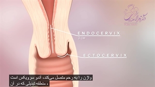 سرطان دهانه رحم (HPV)