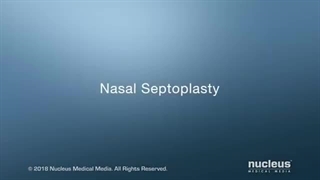 جراحی انحراف سپتوم (سپتوپلاستی)