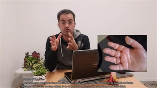 گیاه Giant Hogweed