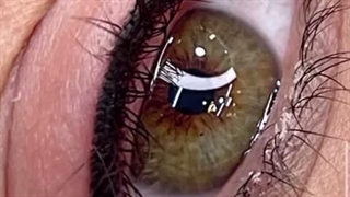 مرکز تخصصی ابرو چشم لب