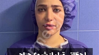 جراحی ترمیمی بینی