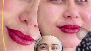 مرکز تخصصی ابرو چشم لب