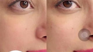 مرکز تخصصی ابرو چشم لب