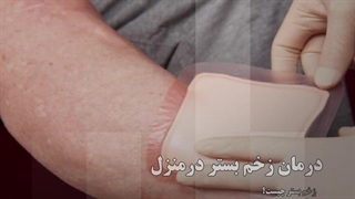 درمان زخم بستر در منزل