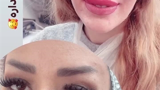 مرکز تخصصی ابرو چشم لب