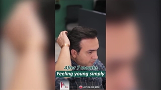 Using 3D Technology for Hair Restoration