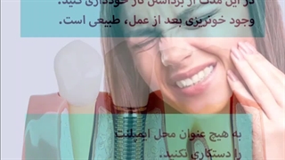 مراقبت بعد ایمپلنت