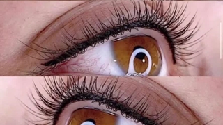 مرکز تخصصی ابرو چشم لب