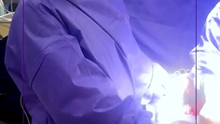 خروج رحم بدلیل خونریزی شدید