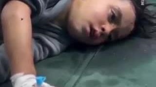 حال و روز اطفال در  غزه    او آنقدر درد دارد که حتی نمی تواند فریاد بزند.  