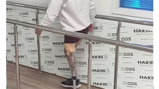 پروتز بالای زانو سیلیکونی - استامپ کوتاه