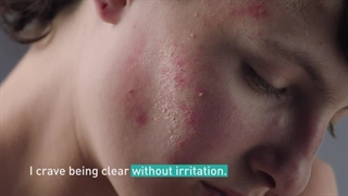 قشم مارت - فوم شست‌ و شو ضد جوش سراوی CeraVe