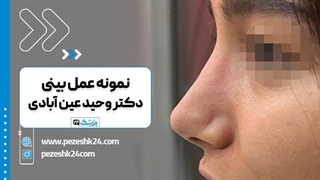 دکتر وحید عین آبادی بهترین دکتر جراح بینی در شیراز رادیوگرافی دندان
