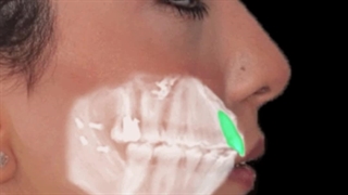 ارتودنسی و جراحی فک و چانه | دکتر داودیان