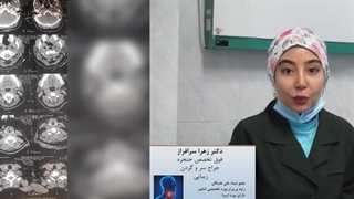 جراحی حنجره با لیزر توسط جراح نخبه ی ایرانی، دکتر زهرا سرافراز عصب‌کشی
