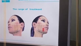 جشنواره هایفو